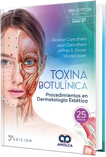 Toxina botulínica. Procedimientos en dermatología estética