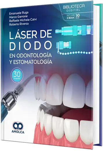 Láser de diodo en odontología y estomatología