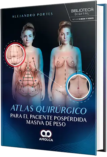 Atlas quirúrgico para el paciente pospérdida masiva de peso