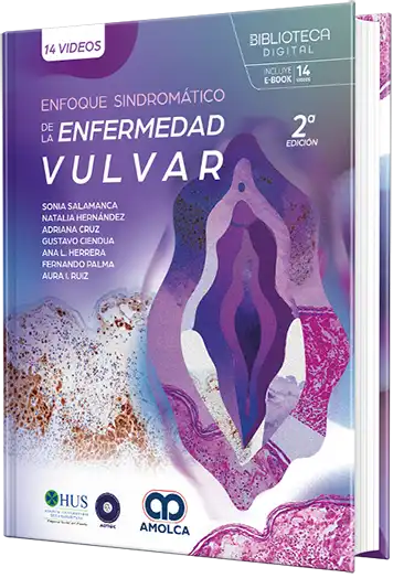 Enfoque sindromático de la enfermedad vulvar, 2.a edición