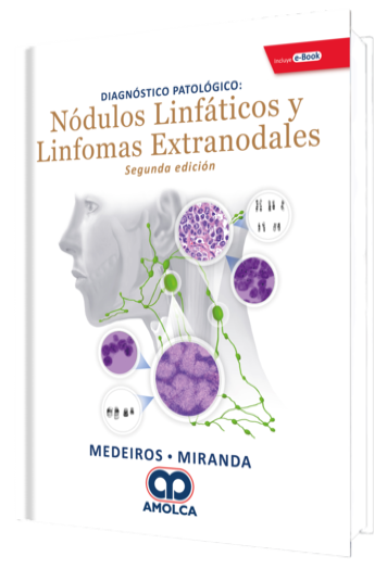Diagnóstico Patológico Nódulos Linfáticos y Linfomas Extranodales. 2 Edición