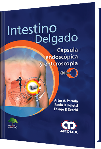 Intestino Delgado. Cápsula Endoscópica y Enteroscopia