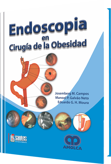 Endoscopia en Cirugía de la Obesidad