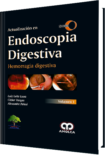 Actualización en Endoscopia Digestiva. Hemorragia Digestiva Volumen 1