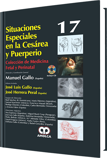 Situaciones Especiales en la Cesárea y Puerperio. Volumen 17
