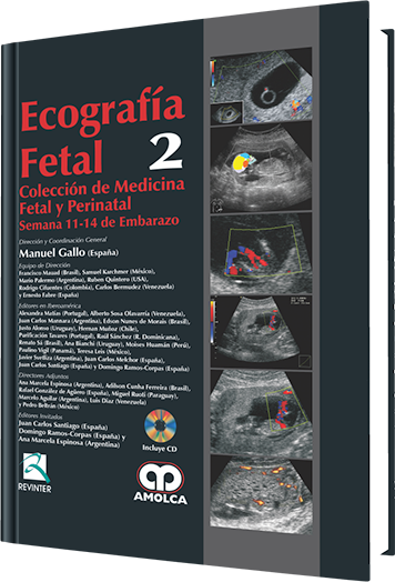 Ecografía Fetal Semana 11-14 de Embarazo. Volumen 2
