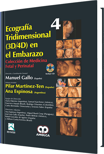 Ecografía Tridimensional (3D/4D) en el Embarazo. Volumen 4
