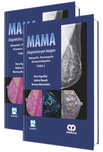 Mama. Diagnóstico por Imagen