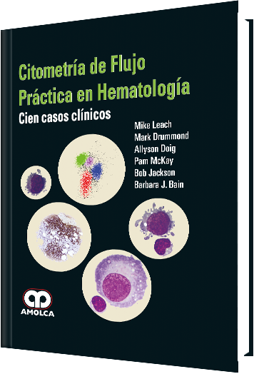 Citometría de Flujo Práctica en Hematología. Cien casos clínicos