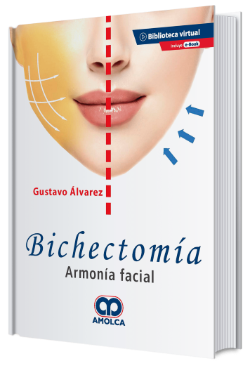 Bichectomía. Armonía Facial