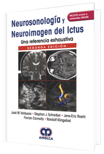 Neurosonología y Neuroimagen del Ictus una Referencia Exhaustiva.  2 Edición