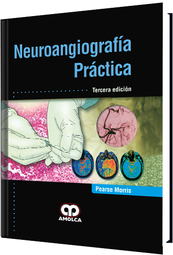 Neuroangiografía Práctica. 3 Edición