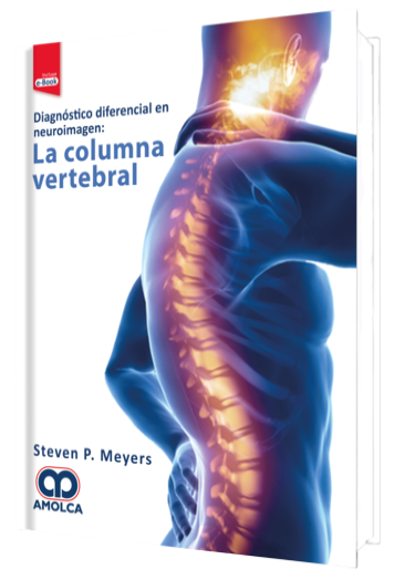 Diagnóstico Diferencial en Neuroimagen: La Columna Vertebral
