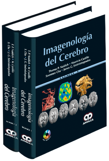 Imagenología del Cerebro