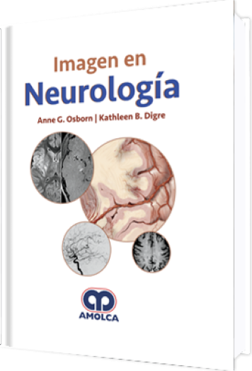 Imagen en Neurología
