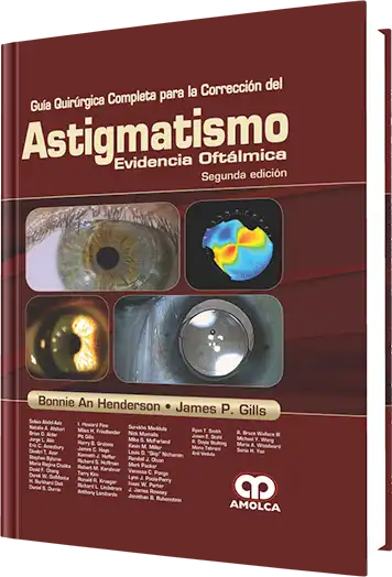 Guía Quirúrgica Completa para la Corrección del Astigmatismo. Evidencia Oftálmica