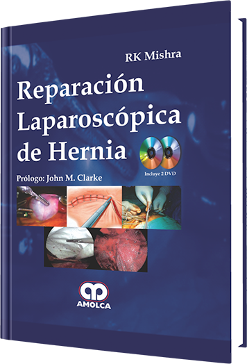 Reparación Laparoscópica de Hernia