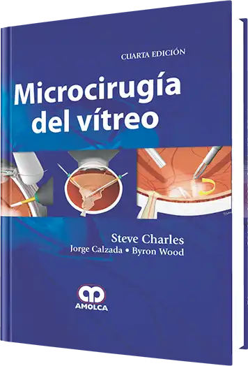 Microcirugía del Vítreo. 4 edición