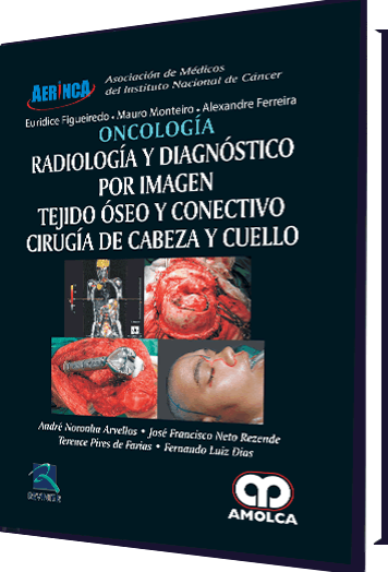 Oncología - Radiología y Diagnóstico por Imagen . Tejido Óseo y Conectivo Cirugía de Cabeza y Cuello