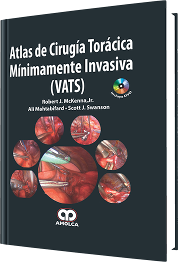 Atlas de Cirugía Torácica Mínimamente Invasiva (VATS)