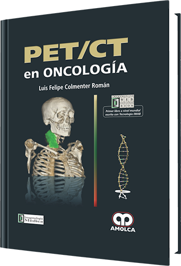PET / CT en Oncología