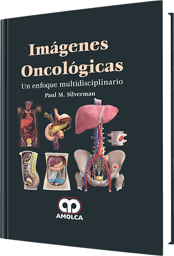 Imágenes Oncológicas