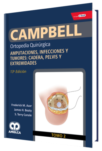 Amputaciones, Infecciones y Tumores: Cadera, Pelvis y Extremidades.  Tomo 2, 13a Edición