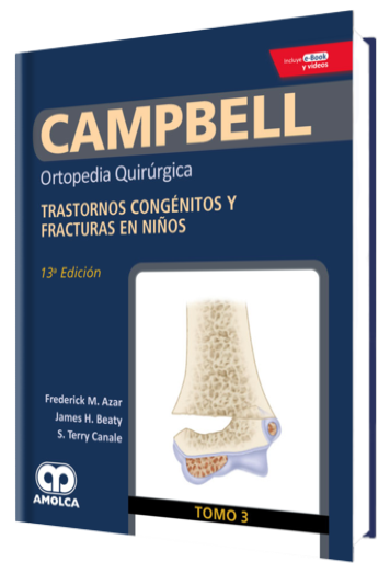 Trastornos Congénitos y Fracturas en Niños Tomo 3, 13 Edición