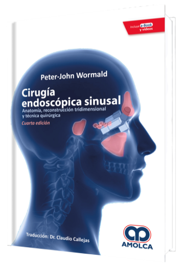 Cirugía Endoscópica Sinusal.  4 Edición