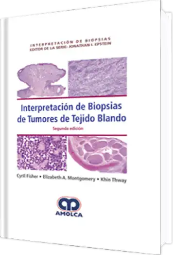 Interpretación de Biopsias de Tumores del Tejido Blando. 2a Edición