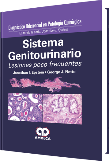 Diagnóstico Diferencial en Patología Quirúrgica Sistema Genitourinario