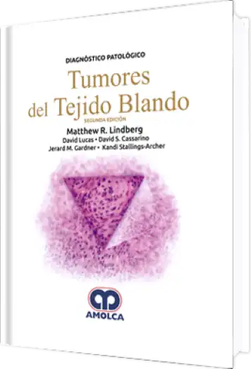 Diagnóstico Patológico. Tumores del Tejido Blando 2a Edición