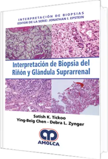 Interpretación de Biopsia del Riñón y Glándula Suprarrenal