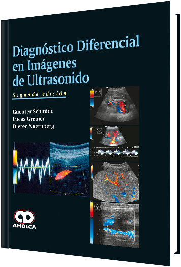 Diagnóstico Diferencial en Imágenes de Ultrasonido. 2 Edición