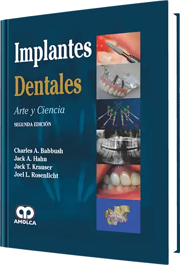 Implantes Dentales. Arte y Ciencia. 2 edición