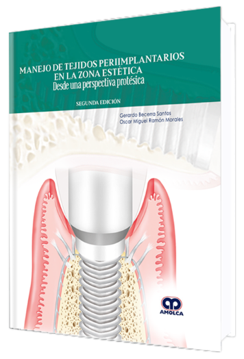 Manejo de Tejidos Periimplantarios en la Zona Estética. Desde una Perspectiva Protésica. 2 edición
