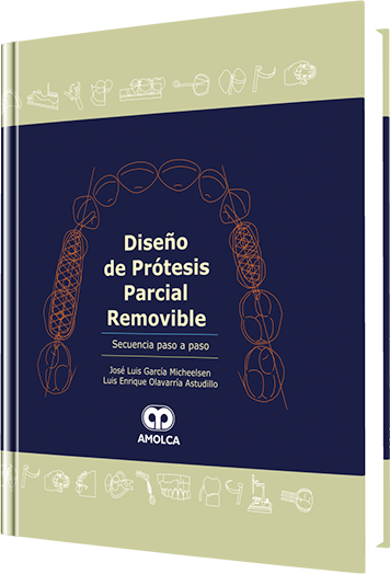Diseño de Prótesis Parcial Removible