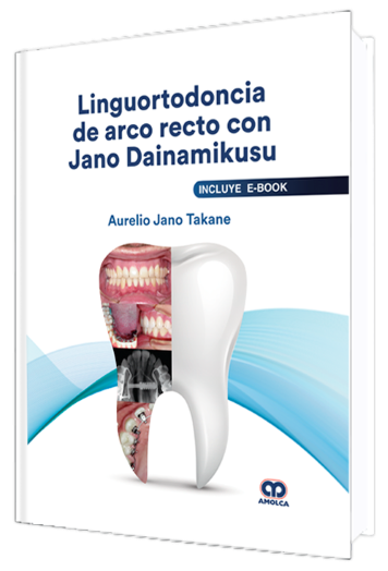 Linguortodoncia de Arco Recto con Jano Dainamikusu