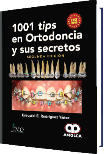 1001 tips en Ortodoncia y sus Secretos 2 Edición