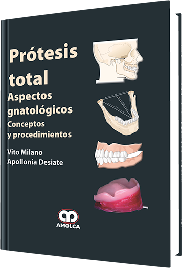 Prótesis Total