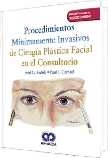 Procedimientos Mínimamente Invasivos de Cirugía Plástica Facial en el Consultorio