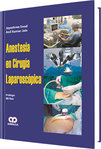 Anestesia en Cirugía Laparoscópica