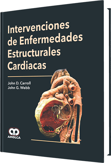 Intervenciones de Enfermedades Estructurales Cardiacas