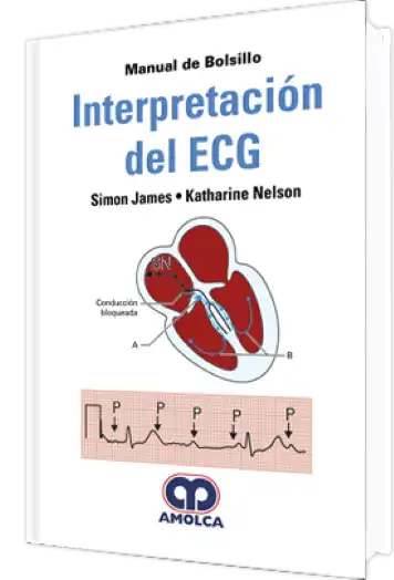 Manual de Bolsillo Interpretación del ECG