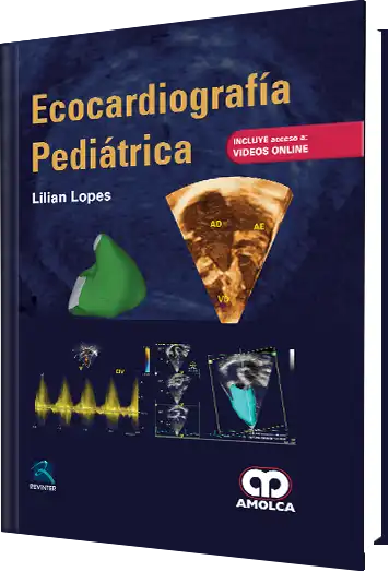 Ecocardiografía Pediátrica