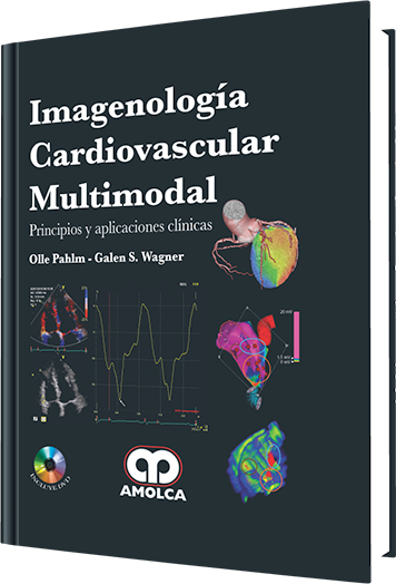 Imagenología Cardiovascular Multimodal