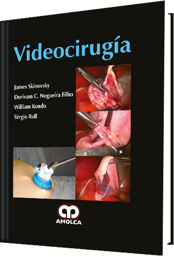Videocirugía