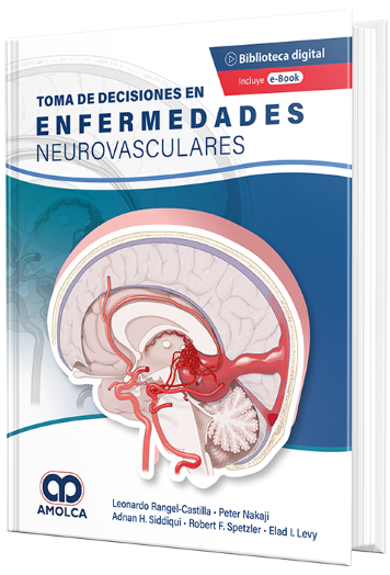 Toma de Decisiones en Enfermedades Neurovasculares