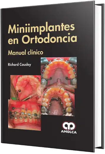 Miniimplantes en Ortodoncia Manual Clínico