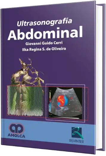Ultrasonografía Abdominal
